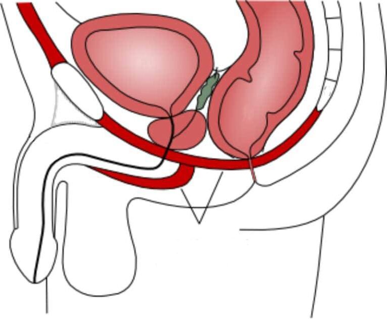 rèn luyện cơ sàn chậu để cải thiện hiệu lực
